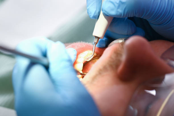 Best Emergency Denture Repair in Honesdale, PA