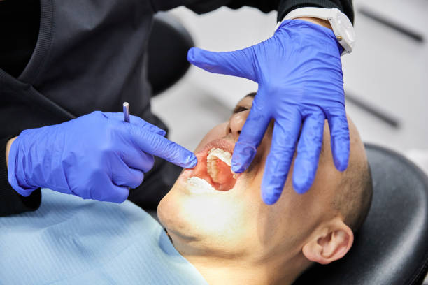 Best Broken or Chipped Tooth Repair in Honesdale, PA